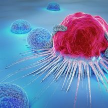Alternative Payment Model Suggested For Prostate Cancer