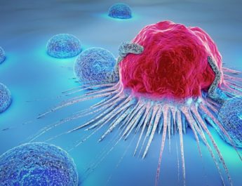 Alternative Payment Model Suggested For Prostate Cancer
